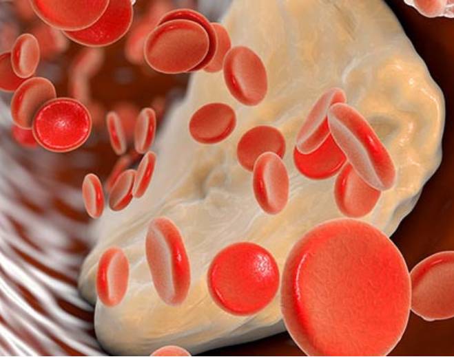 Red blood cells near arterial plaque